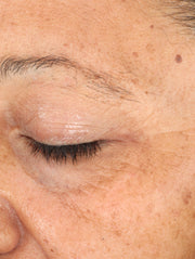 Close up of face after using product
